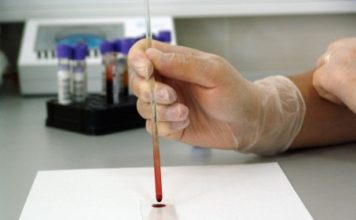 ¿Es posible hacerse la prueba del COVID-19 de manera particular?